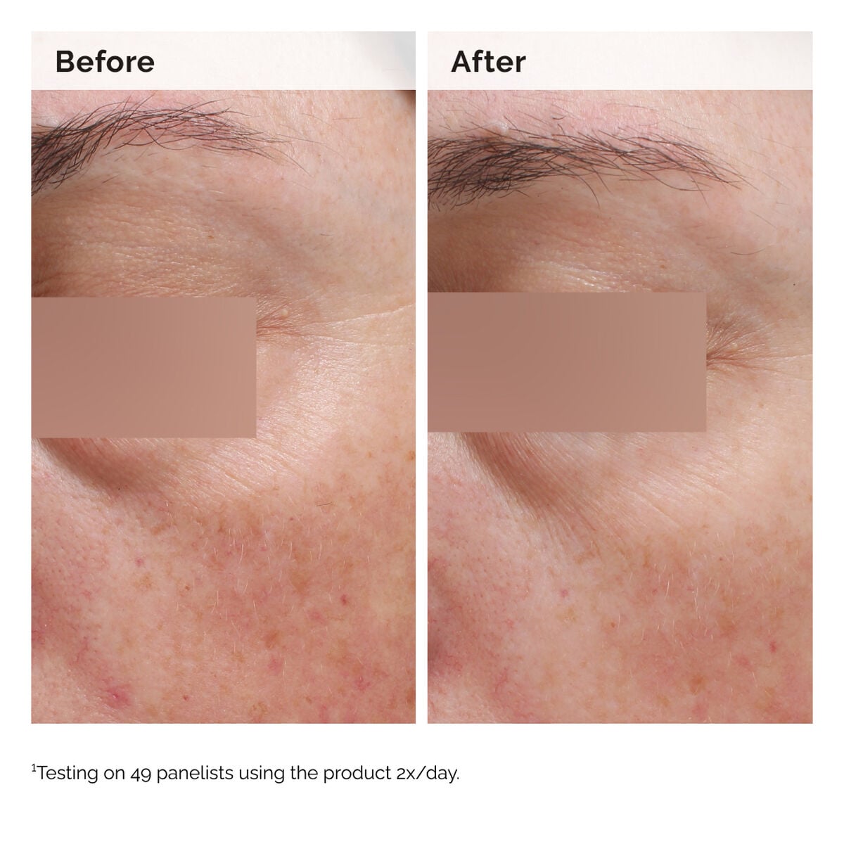 niacinamide-5-face-and-body-emulsion-f6 2024-08-23-ORD-Nia-5pct-Face-Body-B-A-Elasticity-Global-02-1x1.jpg