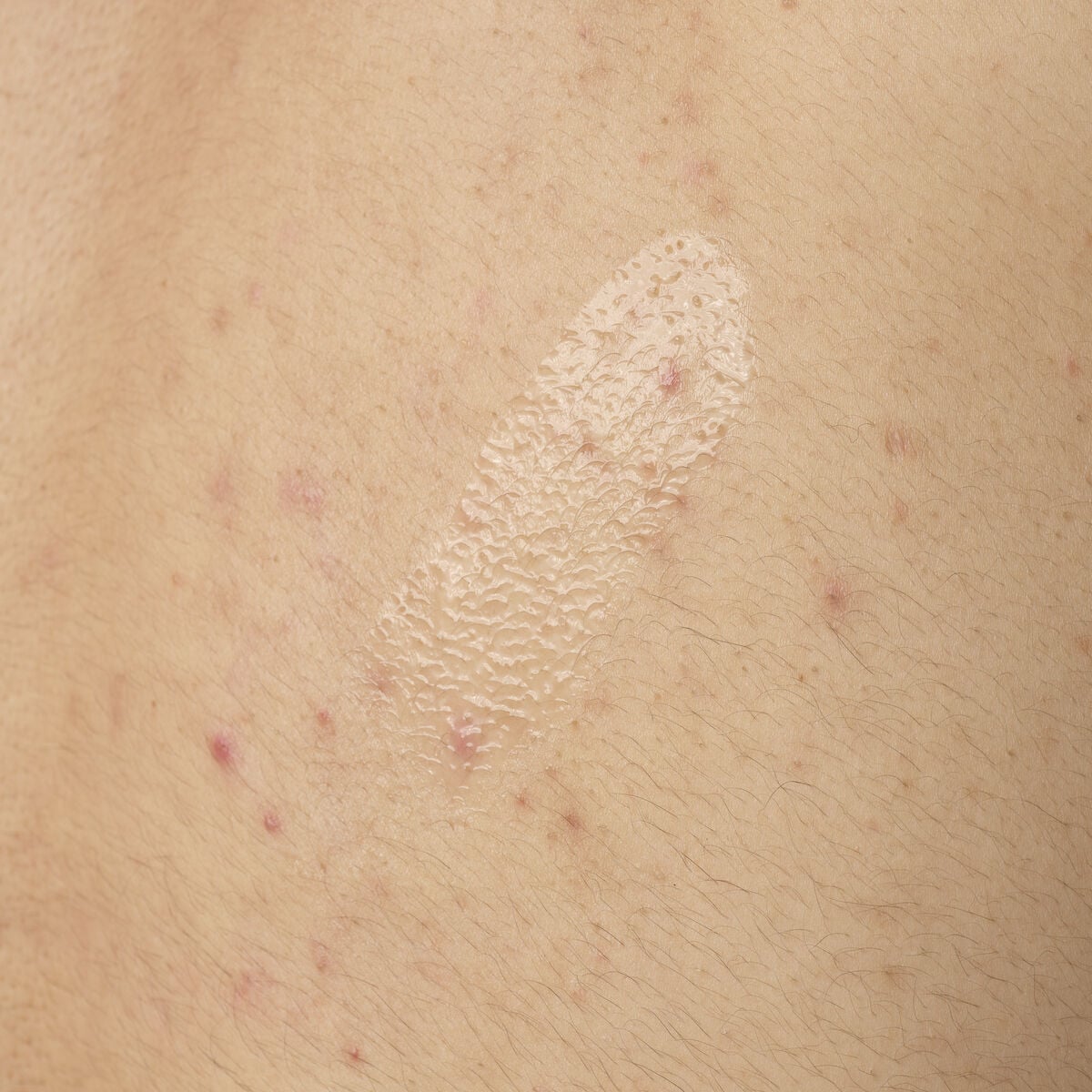 salicylic-acid-0-5-body-serum-k7 ORD-salicylic-acid-05-body-240ml-application.jpg