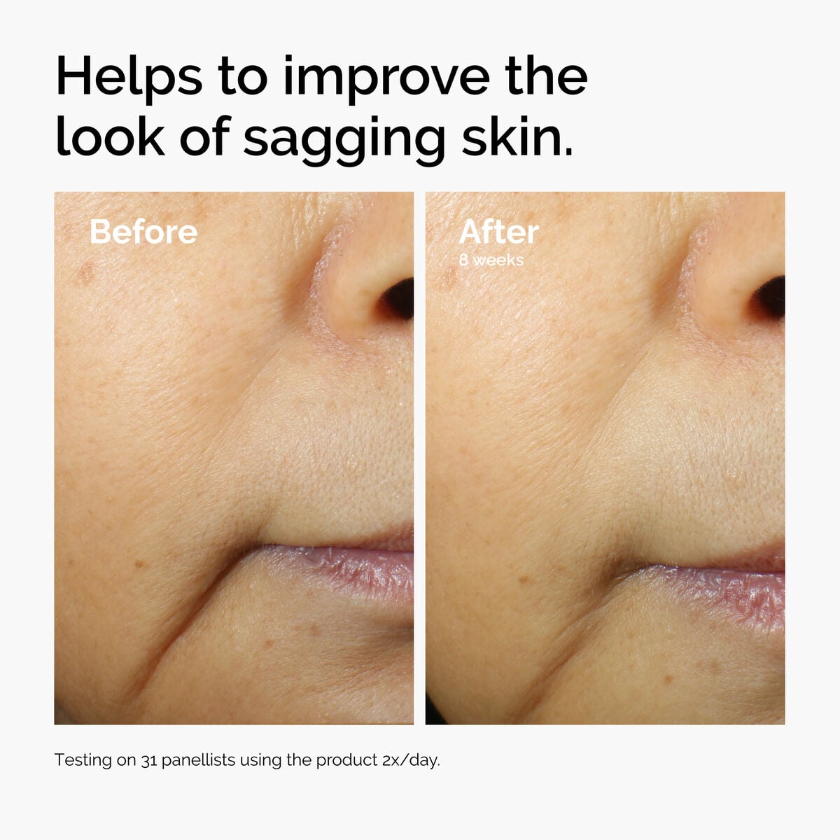 caffeine-3-escin-1-face-serum-g8 ord-caffeine-3pct-escin-1pct-face-serum-before-after-sagging.jpg