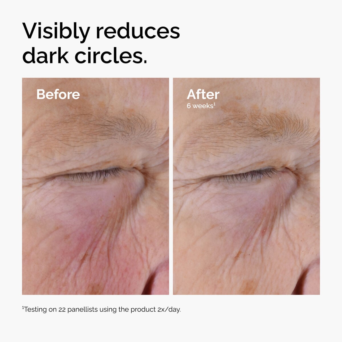 caffeine-solution-5-egcg-eye-serum-i8 ord-caffeine-solution-egcg-dark-circles-before-after.jpg