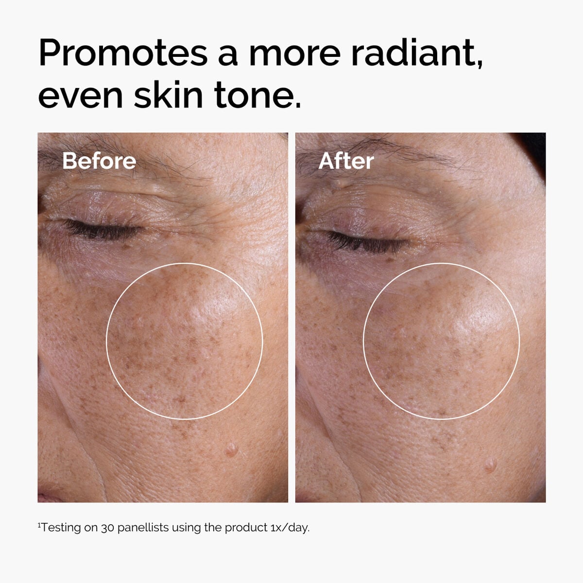 glycolic-acid-7-exfoliating-toner-d4 ord-glycolic-before-after-radiance.jpg