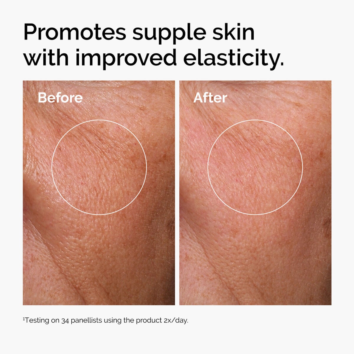 hyaluronic-acid-2-b5-with-ceramides-t8 ord-hyaluronic-acid-2pct-b5-hydrating-serum-before-after-elasticity.jpg