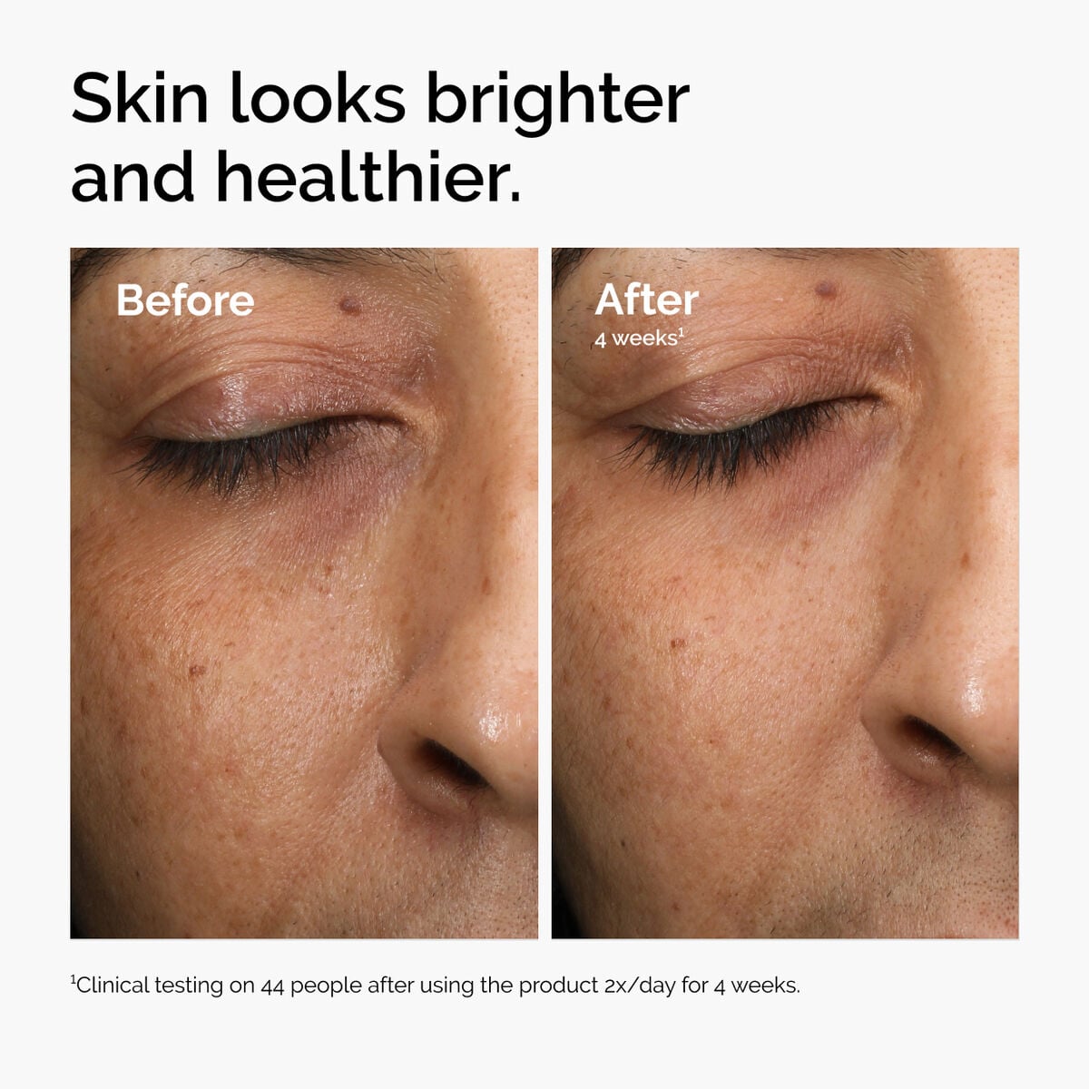 multi-antioxidant-radiance-serum-m8 ord-mars-before-after-healthy.jpg