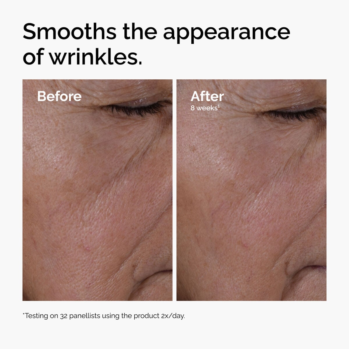 multi-peptide-ha-serum-k4 ord-multi-peptide-ha-serum-wrinkles-before-after.jpg