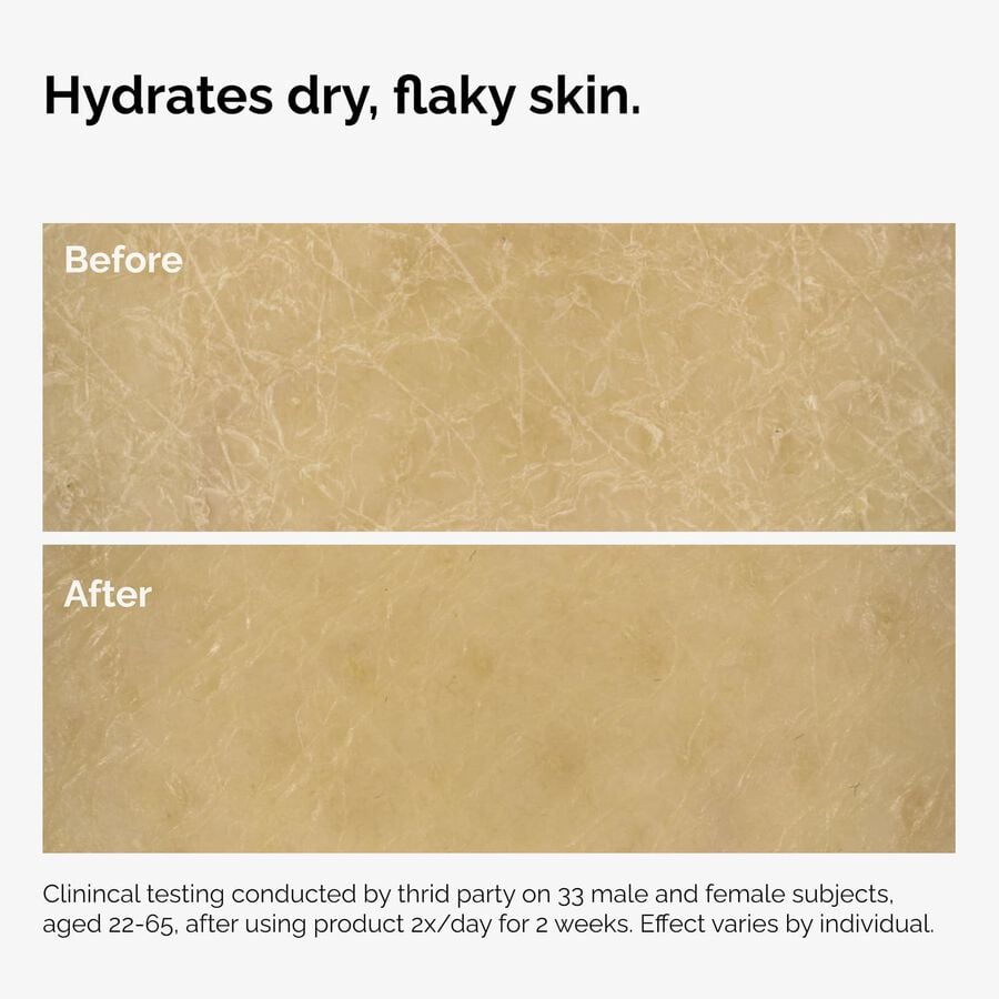 the-body-care-collection-y2 ord-natural-moisturizing-factors-inulin-body-before-after-graphic-02.jpg