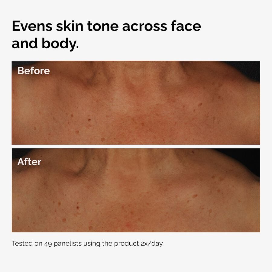 the-body-care-collection-y2 ord-niacinamide-face-body-serum-before-after-even-tone-graphic.jpg