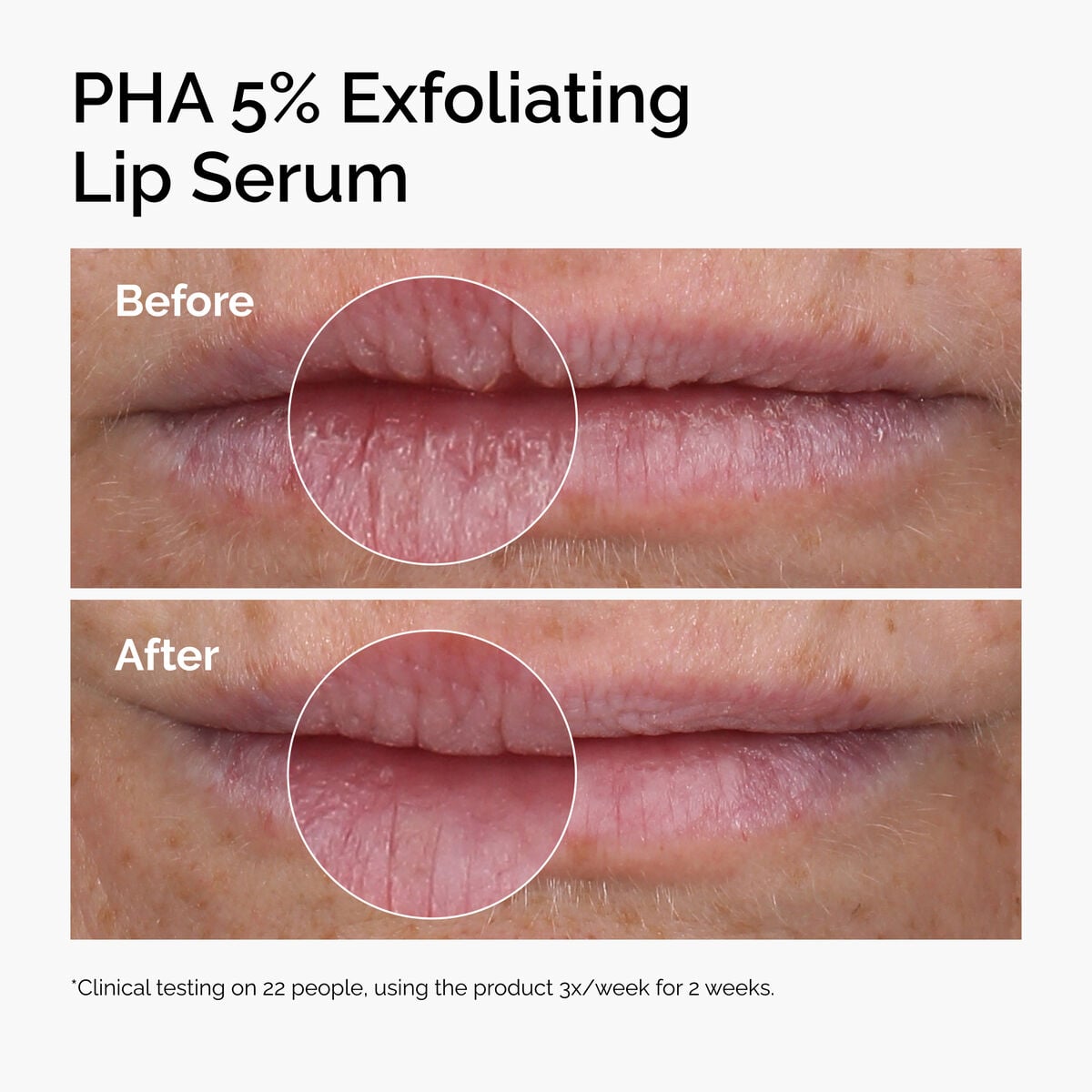pha-5-exfoliating-lip-serum-p6 ord-pha-5pct-lip-exfoliating-serum-before-after.jpg