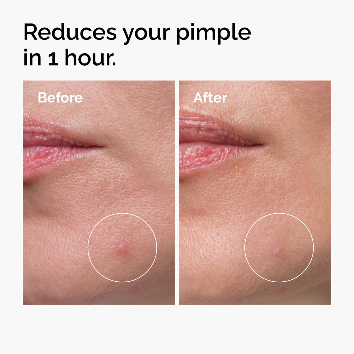 sulfur-10-powder-to-cream-concentrate-f8 ord-sulfur-10pct-powder-to-cream-concentrate-before-after-NA.jpg
